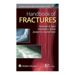 Handbook of Fractures (5th)